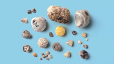 Crohn’s Issues: The 411 on Gallstones 9 Crohns Complications The 411 on Gallstones