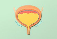 Fixing Urine Leaks Common Mistakes and Solutions