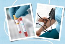 High Blood Pressure and Cholesterol Before Age 55 May Cause