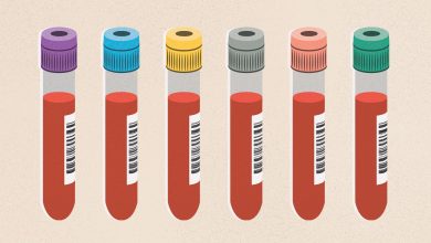 Top 11 Questions About High Cholesterol Answered