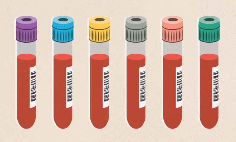 Prime 11 Questions About Excessive Ldl cholesterol, Answered 1 Top 11 Questions About High Cholesterol Answered
